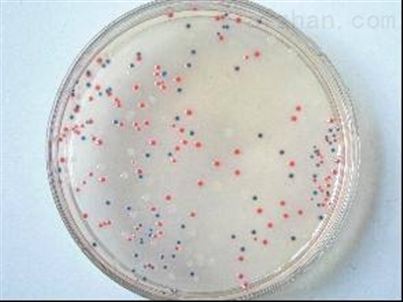 科学家发现可以降解塑料的假单胞菌 未来有可能生产生物塑料