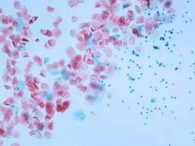 空气传播的微塑料污染遍布全球 约85%与道路交通有关